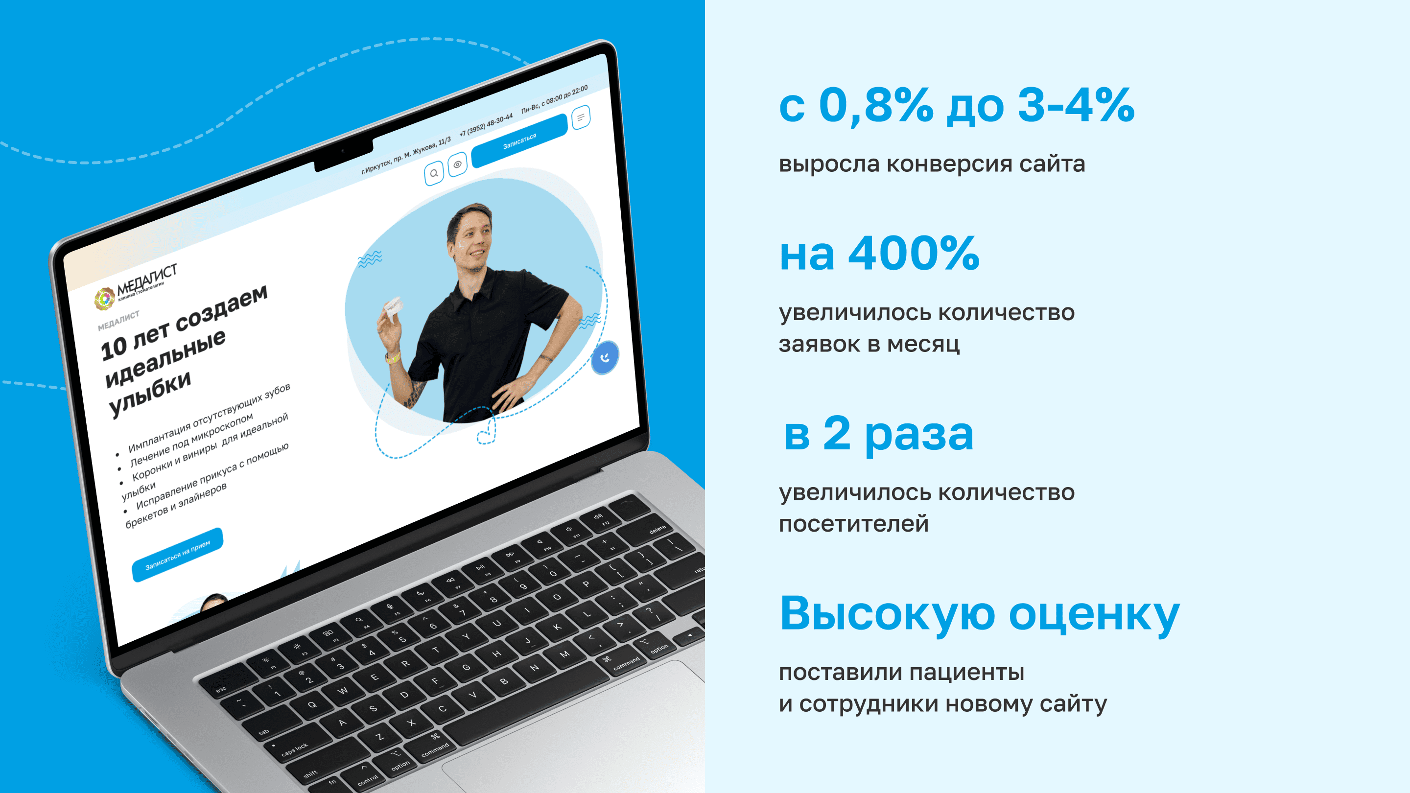 МР в разработке это